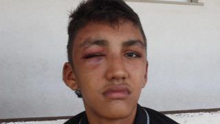 Adolescente é acusado de furto e agredido por empresário em Manaus