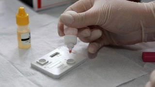 Casos de sífilis voltam a aumentar no Brasil