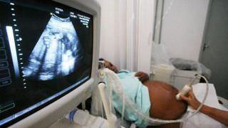 Comissão da Câmara inclui polêmica sobre aborto em PEC da licença-maternidade