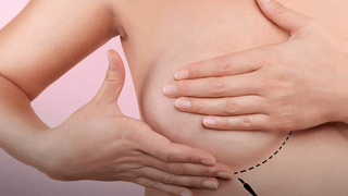 Campanha Quanto Antes Melhor alerta sobre câncer de mama