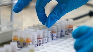 Saúde atualiza dados da Covid-19, Mpox e vacinação neste sábado (17)