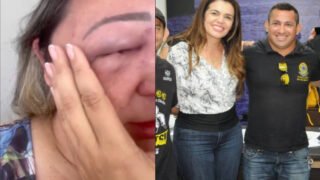 Alessandra Campêlo exonera servidor após caso de agressão contra ex