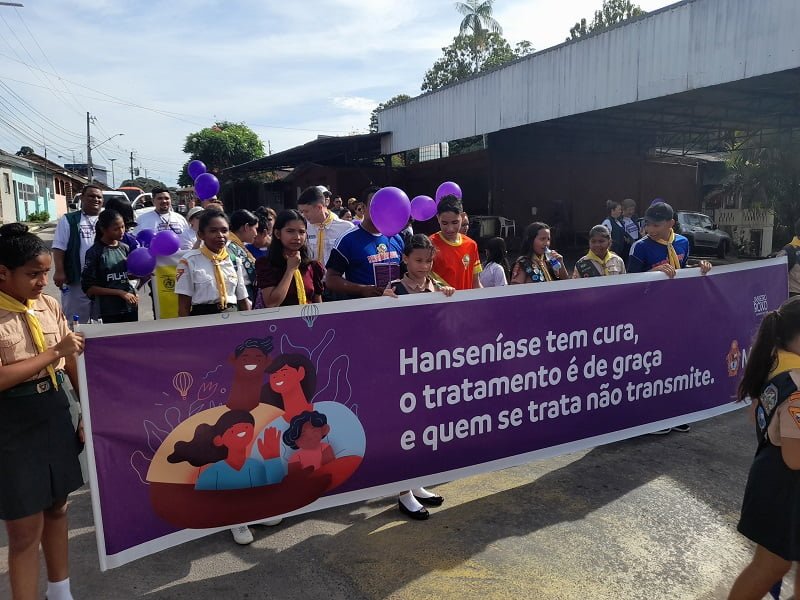 Campanha Janeiro Roxo (Foto: Divulgação/Semsa) Janeiro Roxo: prefeitura encerra combate à hanseníase, com caminhada na Zona Leste