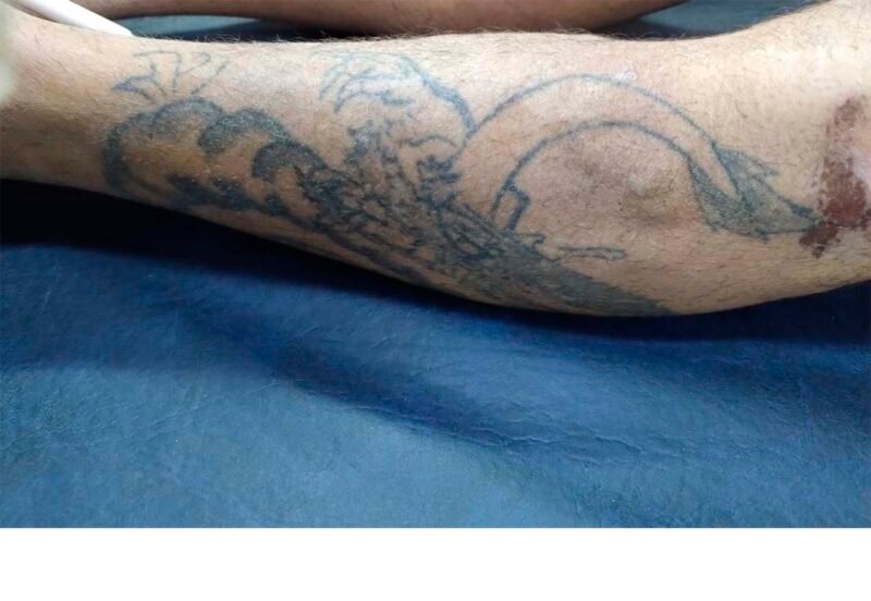 Paciente Erick Augusto Jardim, que está internado na unidade (Foto: Divulgação/SES-AM) HPS Dr. João Lúcio pede ajuda para encontrar familiares de homem internado na unidade