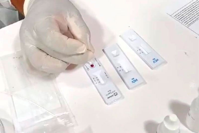 Ttestes rápidos para diagnóstico (Foto: Jaqueline Macedo/FVS-RCP) FVS-RCP realiza mais 432 testes rápidos para diagnósticos de IST’s